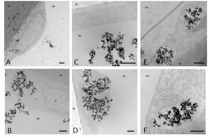 Microscopie lectronique de cellules endothliales crbrales de la BHE exposes  des nanoparticules de TiO2
